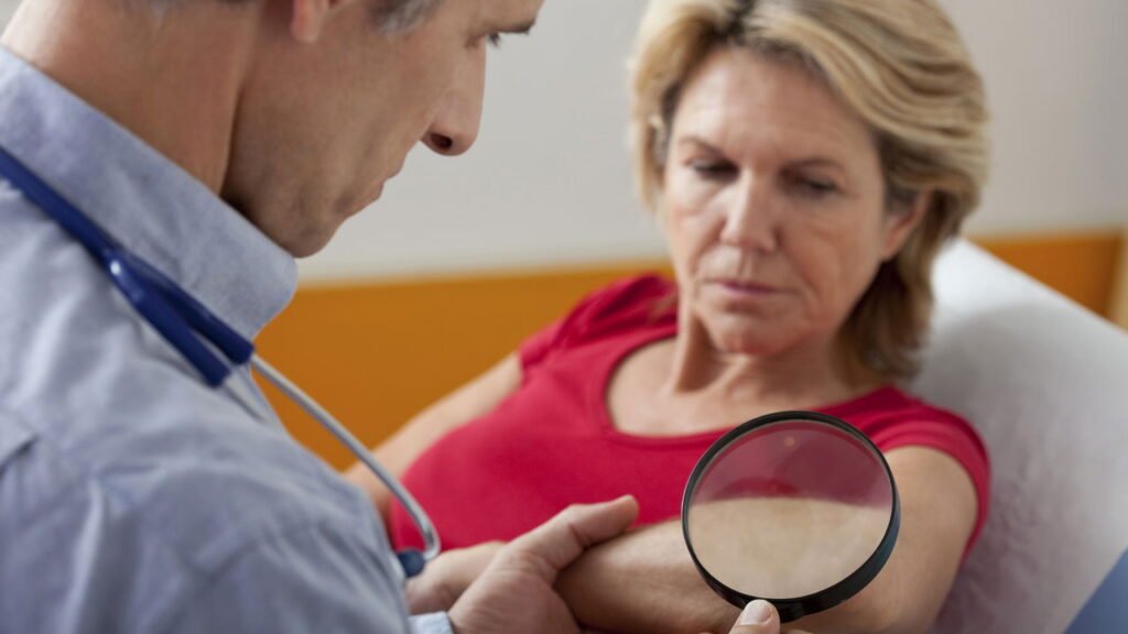 Manchas que mudam de cor podem ser mais perigosas do que você imagina