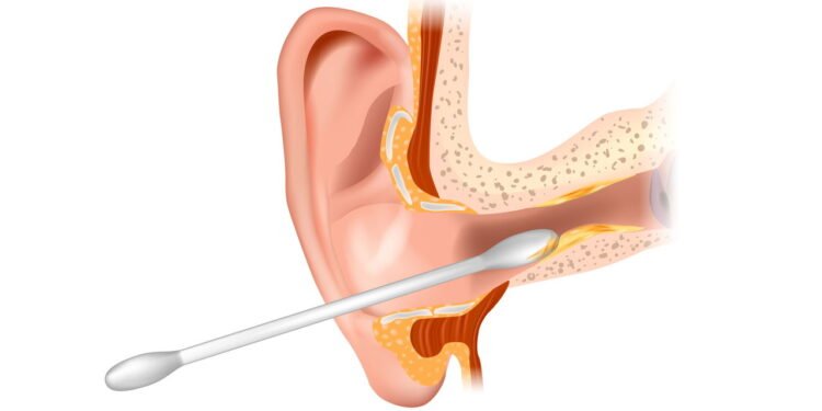 Cera de ouvido -Créditos: depositphotos.com / Sakurra