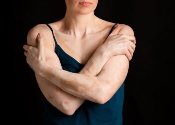 O órgão interno que afeta a sua pele mais do que você imagina