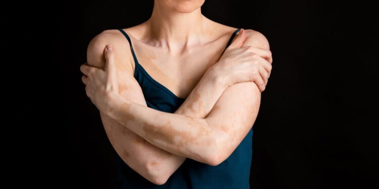 O órgão interno que afeta a sua pele mais do que você imagina