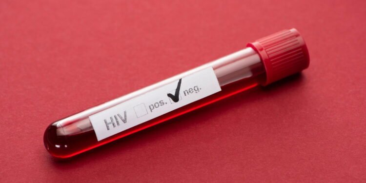 HIV - Créditos: depositphotos.com / VadimVasenin