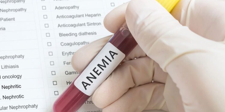 Anemia - Créditos: depositphotos.com / vchalup2