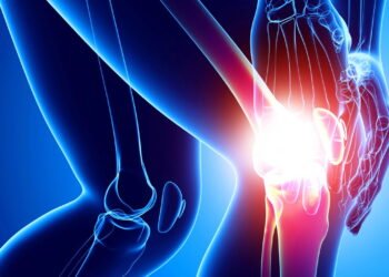 Alimentos que ajudam a reduzir inflamações e dores articulares