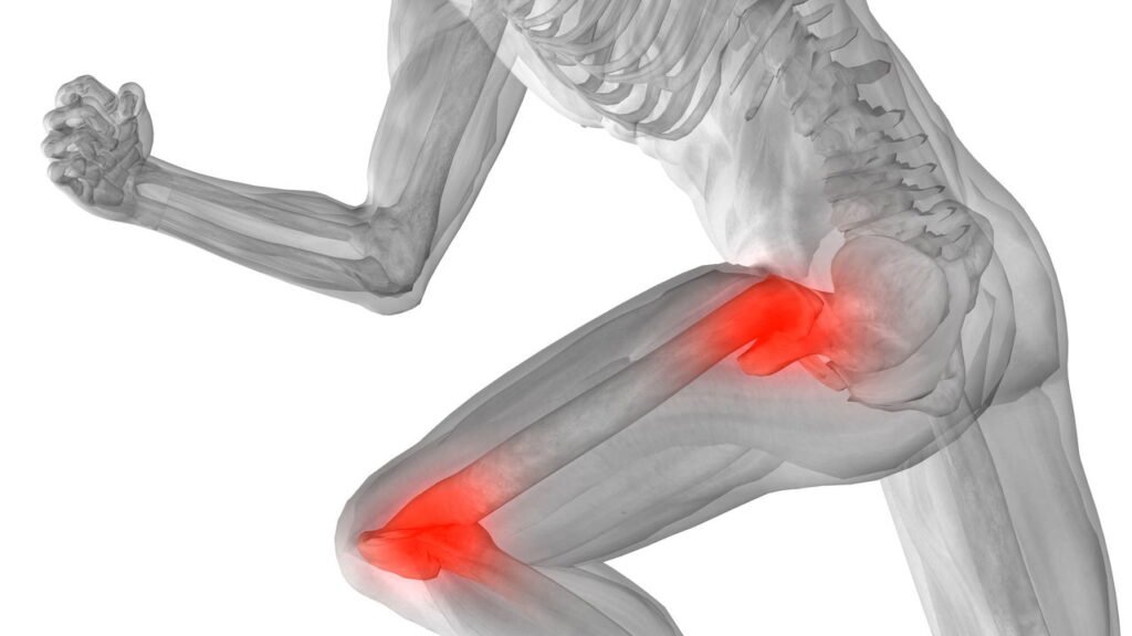 Sintomas que podem indicar artrite e precisam de atenção
