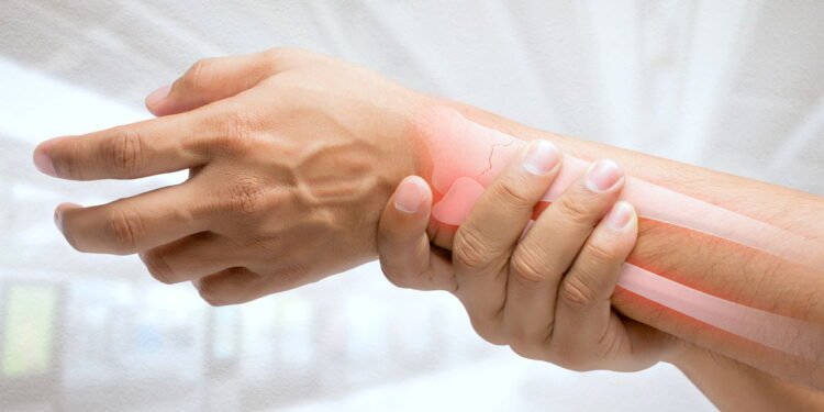 Formigamento nos braços ao acordar é mais comum do que parece e tem solução