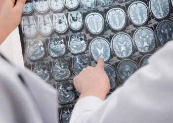 5 hábitos essenciais para manter o cérebro saudável com o avanço da idade