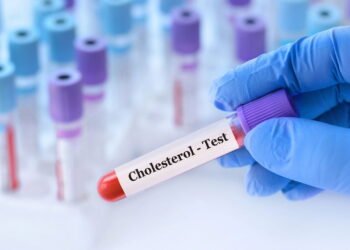 Como reduzir o colesterol alto sem medicamentos de forma segura?