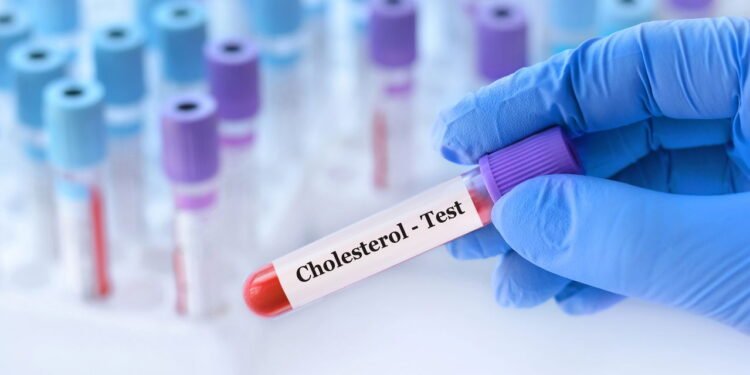 Colesterol // Créditos: depositphotos.com / SyhinStas