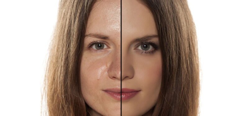 Pele oleosa - Créditos: depositphotos.com / VGeorgiev