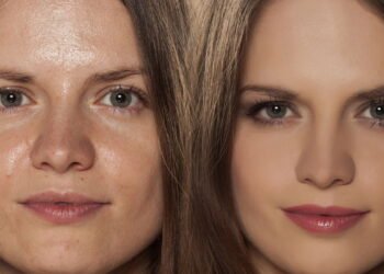 Como cuidar da Pele Oleosa com métodos caseiros que realmente funcionam