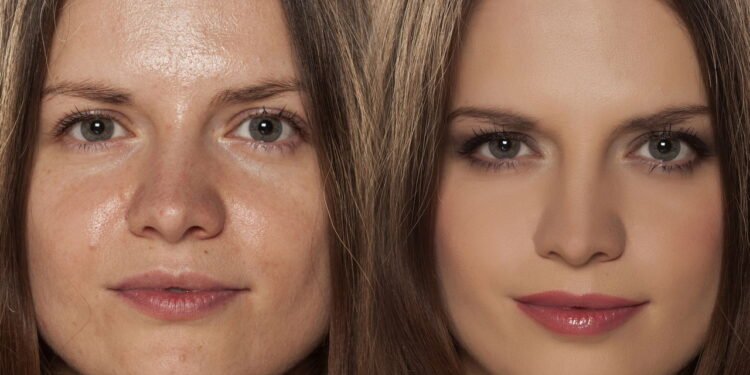 Pele oleosa - Créditos: depositphotos.com / VGeorgiev