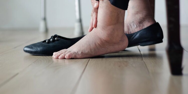 A melhor bebida natural para aliviar pés inchados nos dias quentes