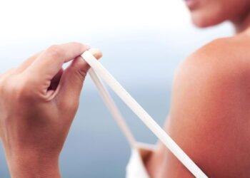 5 dicas infalíveis para prevenir queimaduras solares e manter a pele saudável