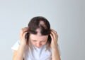 O que é alopecia areata e como tratar a queda de cabelo