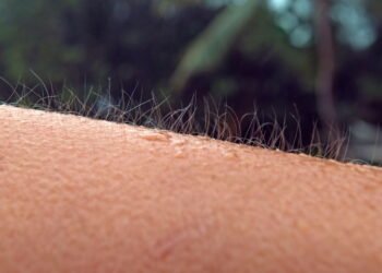 O que significa quando o corpo arrepia sem explicação?