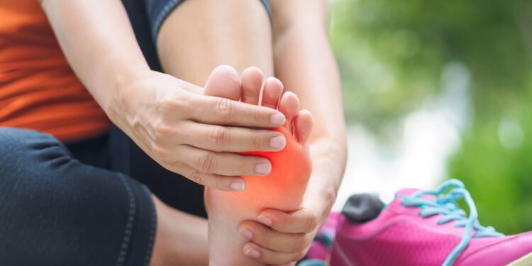 Fascite Plantar - Créditos: depositphotos.com / spukkato