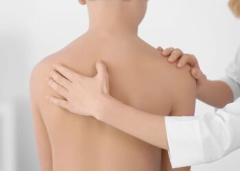 Escoliose leve pode ser controlada com exercícios simples e acompanhamento certo