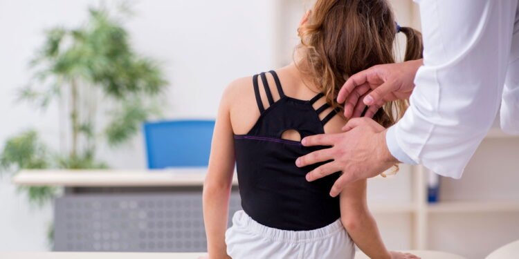 Escoliose aparece no crescimento e fisioterapia previne complicações graves no futuro