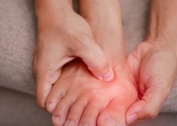 O  que seu Joanete pode revelar sobre sua saúde dos pés