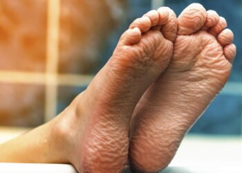 É por isso que você deveria lavar os pés com água morna e limão