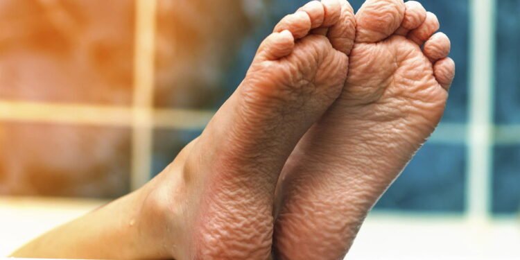 É por isso que você deveria lavar os pés com água morna e limão