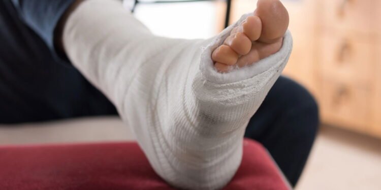 Fisioterapeutas revelam como reduzir tempo de recuperação da entorse de tornozelo