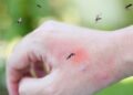 É por isso que os mosquitos picam algumas pessoas mais do que outras