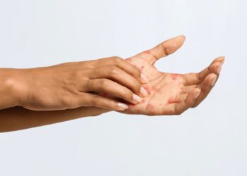 O que significa quando a sua mão esquerda coça do nada?