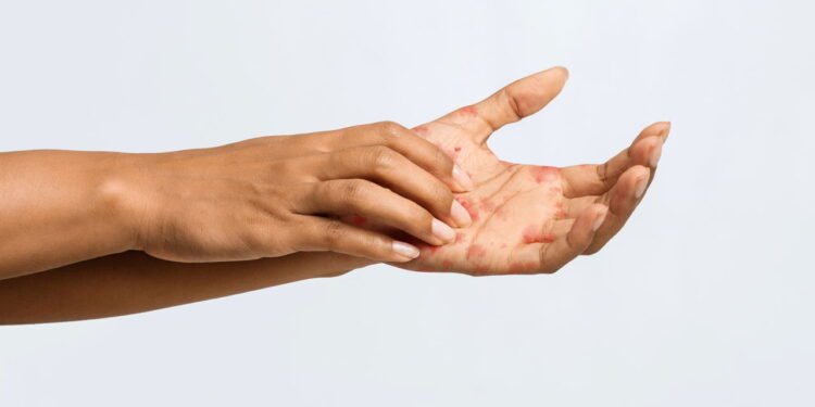 O que significa quando a sua mão esquerda coça do nada?