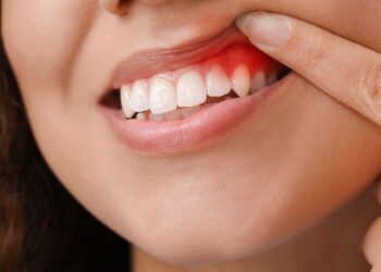 Dr. Claudio Pinho, Dentista: como manter a Saúde da Gengiva e evitar doenças