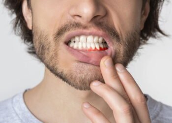 Dr. Claudio Pinho, Dentista: como manter a Saúde da Gengiva e evitar doenças