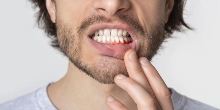 saúde da gengiva - Créditos: depositphotos.com / Milkos