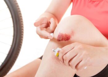 Caiu de moto ou bike? Veja como tratar o ralado