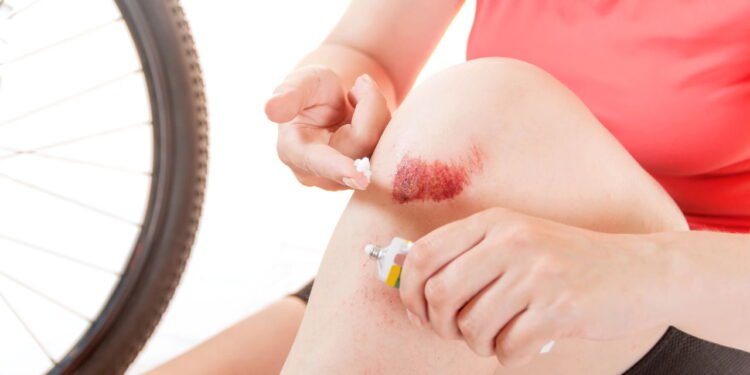 Ralado no Joelho - Créditos: depositphotos.com / Tanchic