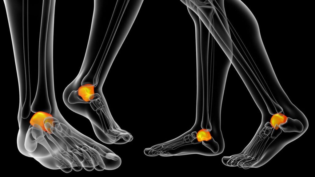 Como fortalecer tendões e ligamentos para ganhar estabilidade e mobilidade