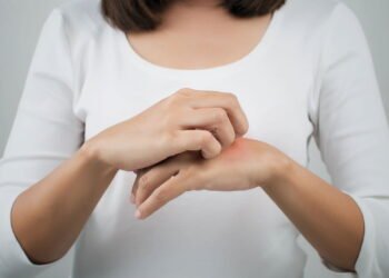 Coceira na mão esquerda pode indicar algo grave