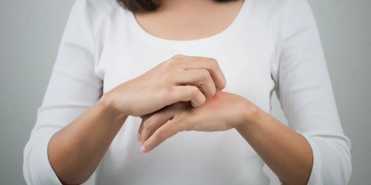 Coceira na Mão  - Créditos: depositphotos.com / Tharakorn