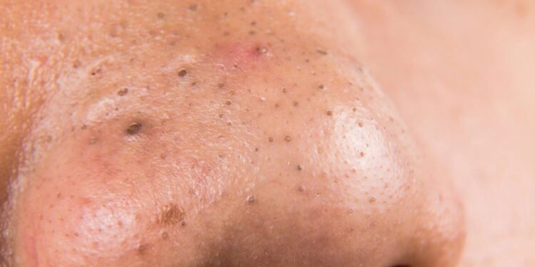 Cravos - Créditos: depositphotos.com / Thamkc