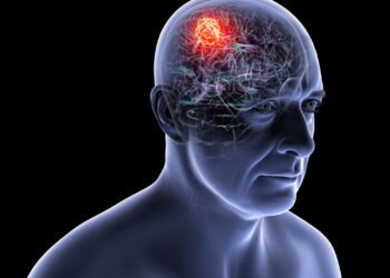 Dr. Baltazar Leão, Neurocirurgião: o tumor cerebral mais agressivo e o desafio da medicina moderna