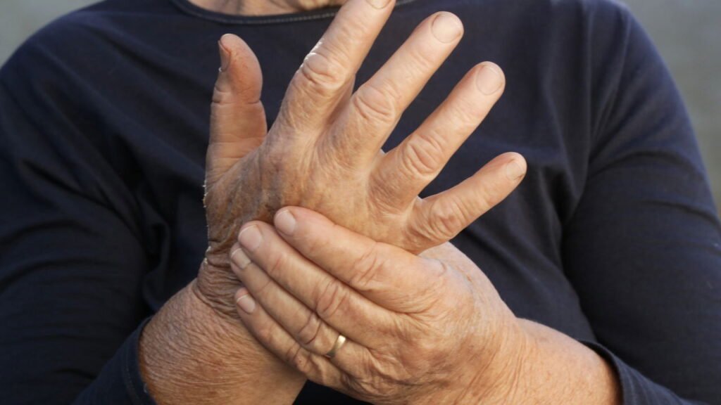 O que significa sentir formigamento nas mãos sem motivo aparente