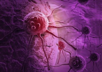 Coisas que podem ajudar a reduzir o risco de câncer de próstata, da dieta ao exercício