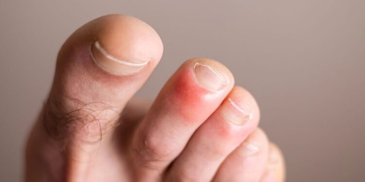 Frieira - Créditos: depositphotos.com / MatiasFabbri