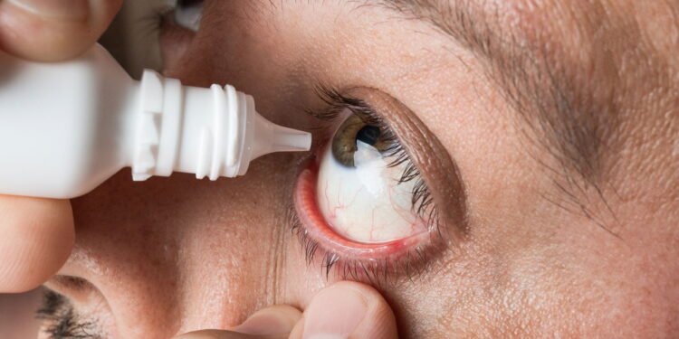 Homem aplicando colírio -  Créditos: depositphotos.com / DedMityay