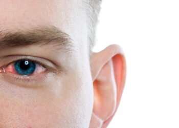 Dra. Tayuane Pinto, Oftalmologista:O que ninguém te contou sobre tuberculose e saúde dos olhos