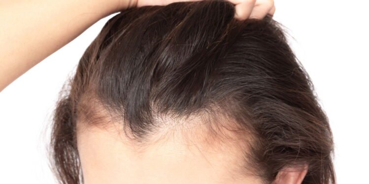 O que causa o afinamento do cabelo segundo as vitaminas