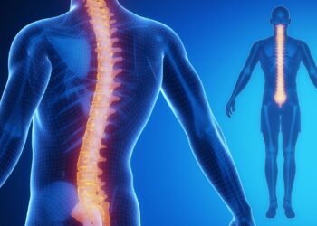 Esse problema na coluna atinge jovens e idosos e pode ser evitado com hábitos simples