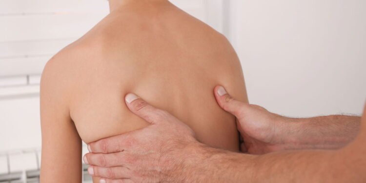 Escoliose tem sinais sutis no início e pode ser tratada sem cirurgia