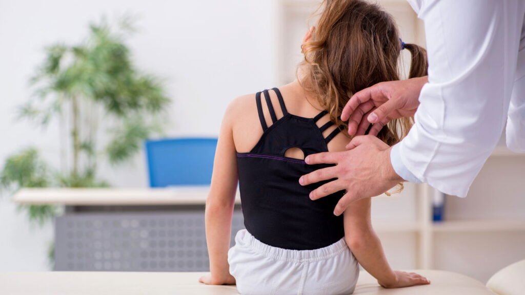 Escoliose tem sinais sutis no início e pode ser tratada sem cirurgia