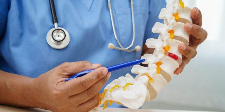 Essa condição na lombar atinge muita gente depois dos 50 e atrapalha até pequenas tarefas