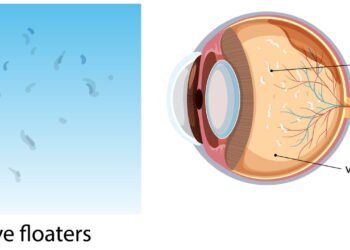 Dra. Tayuane Pinto, Oftalmologista: Manchas na visão podem ser perigosas
